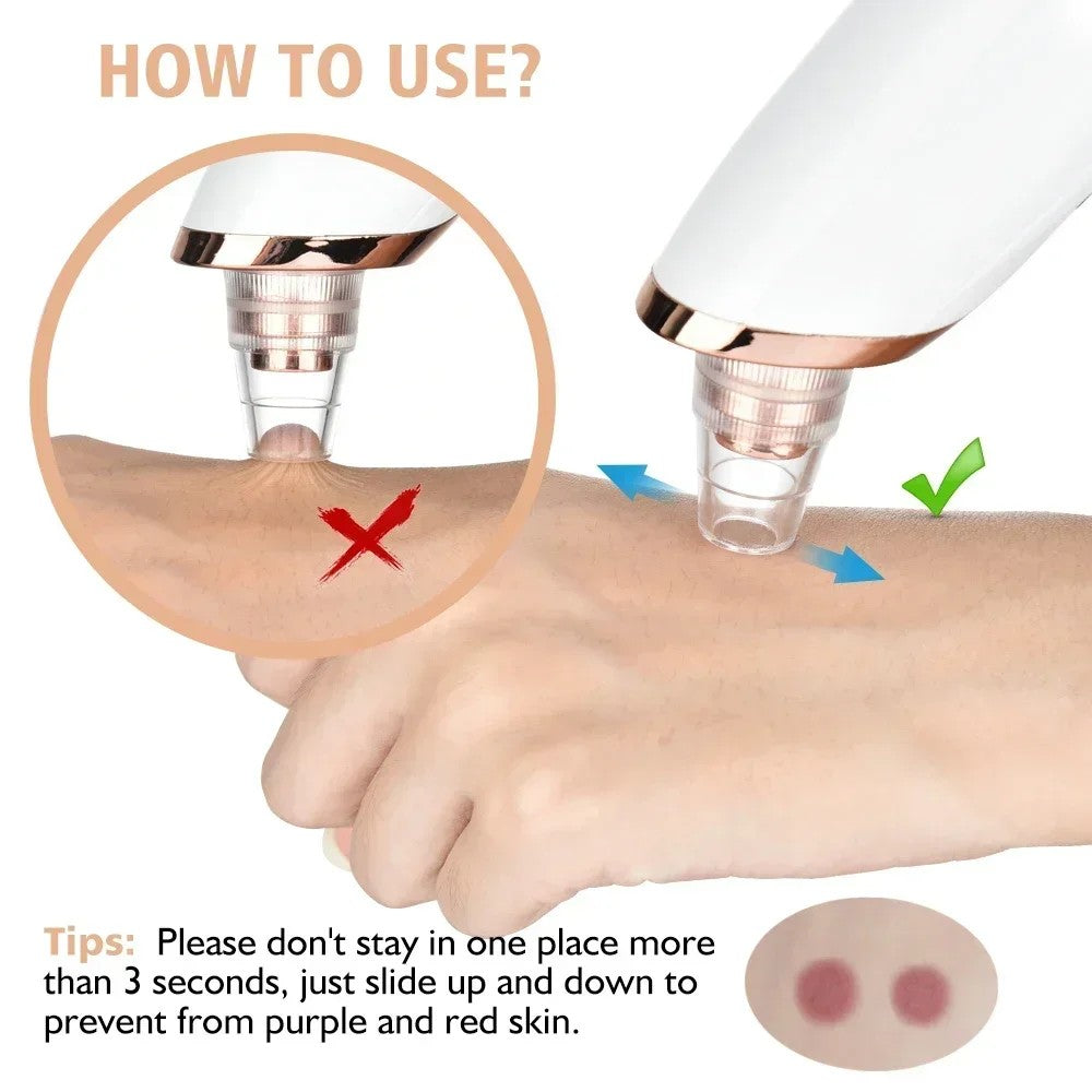 GCS Electric Blackhead Remover