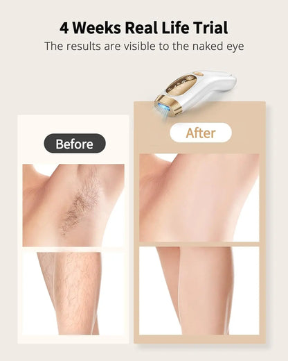 GCS IPL Hair Removal