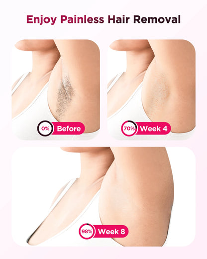 GCS Ice Cooling Laser Hair Removal